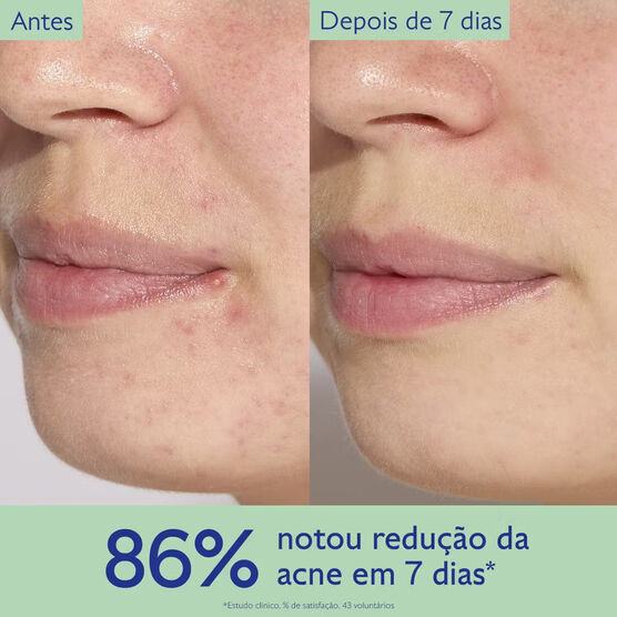 S&eacute;rum Facial Salic&iacute;lico Caudalie Vinopure